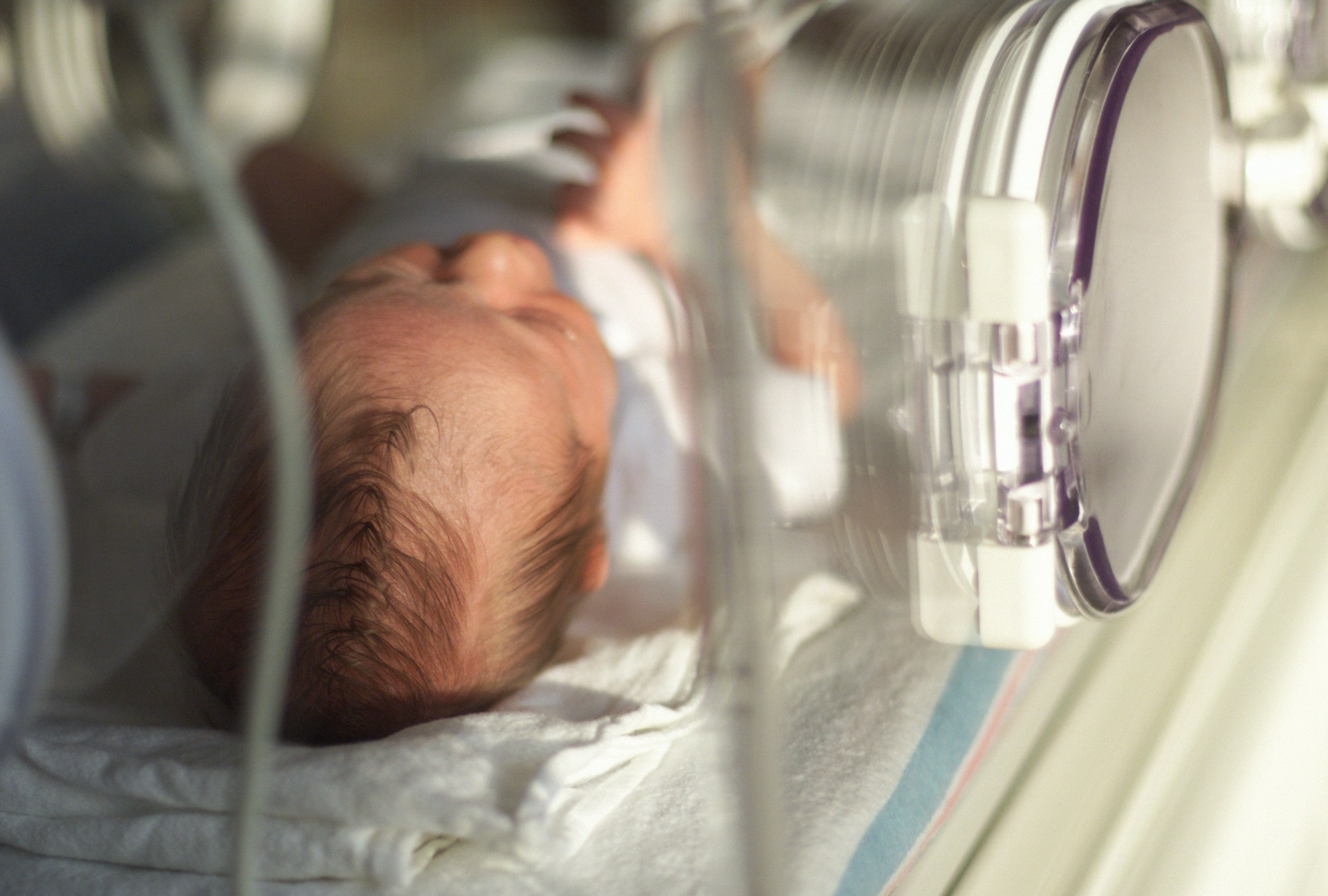 NICU